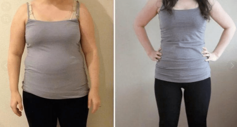 преди и след резултатите от диетата на дукан